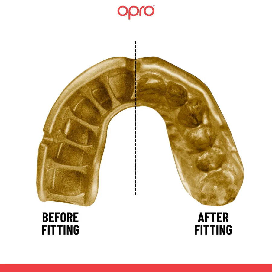 OPRO Gold Mouthguard